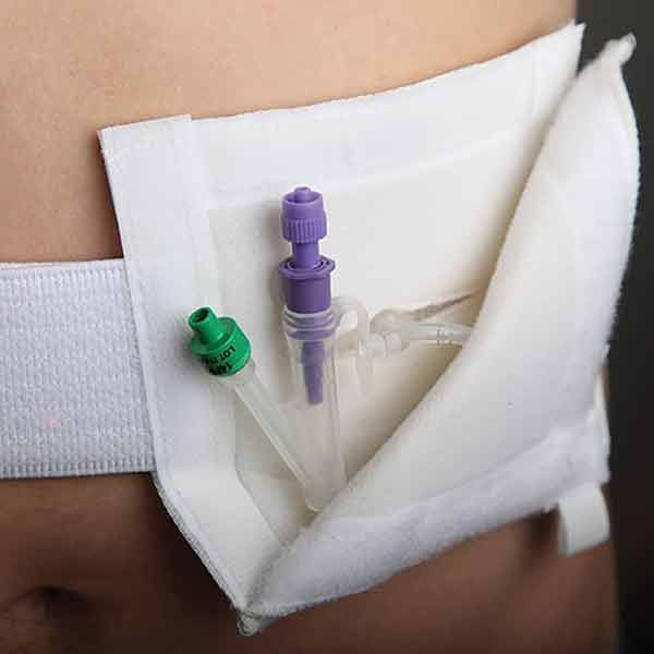 Medicina Gastrostomy Tidy Medium 75cm-114cm